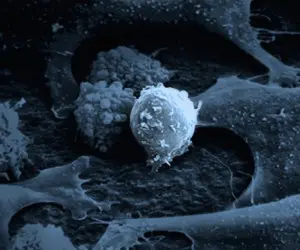 stem_cell