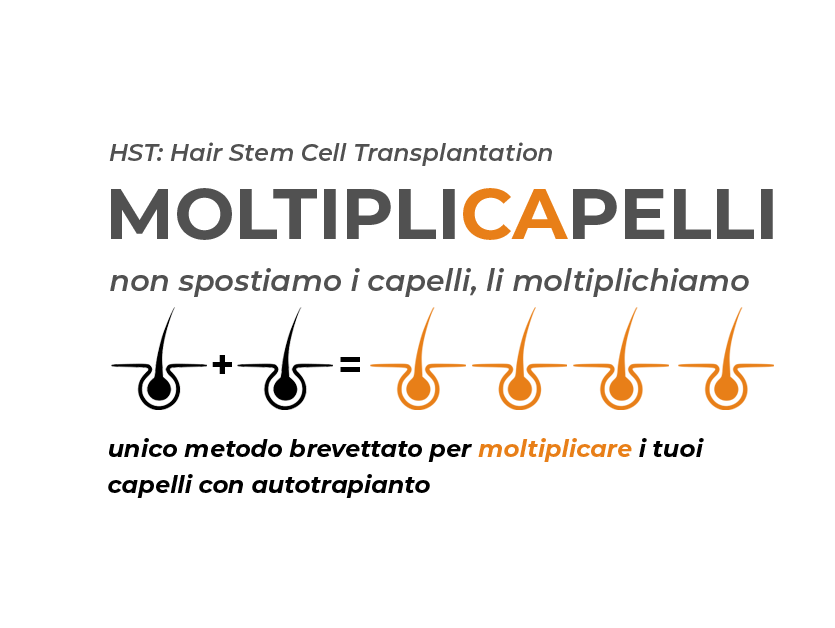 IN ITALIA UNA TECNICA TRAPIANTO CAPELLI RIVOLUZIONARIA: LA HST – PL – FUT