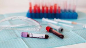 Come leggere analisi del sangue