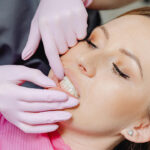 dente scheggiato cosa fare