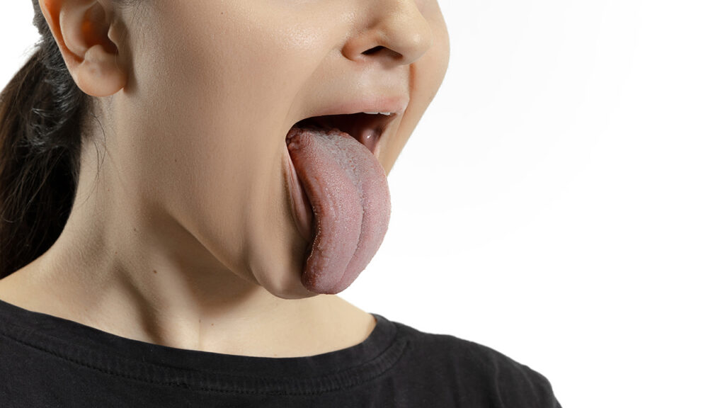 saliva densa