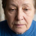 xantelasmi cosa sono