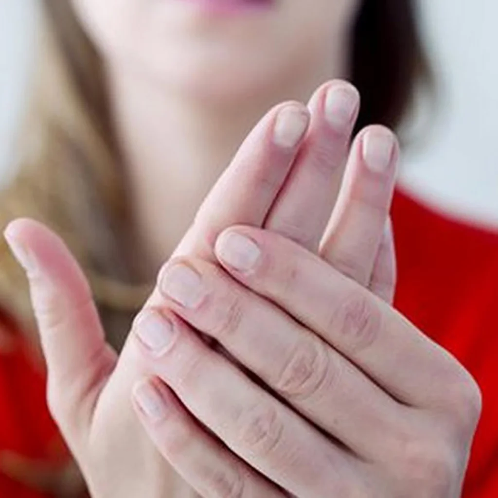 macchie bianche sulle unghie cause