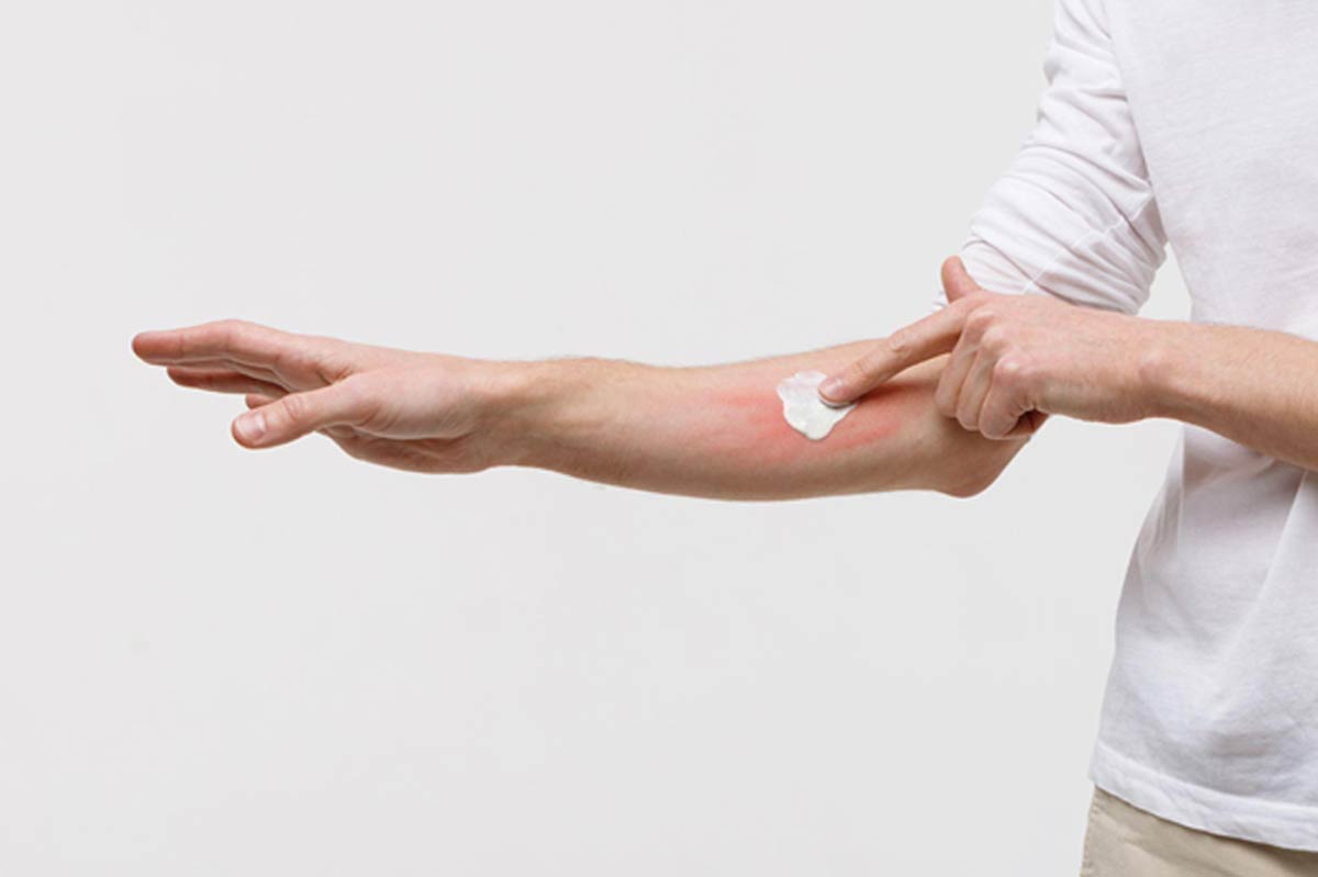 Dermatite atopica e stress: come la mente parla alla pelle