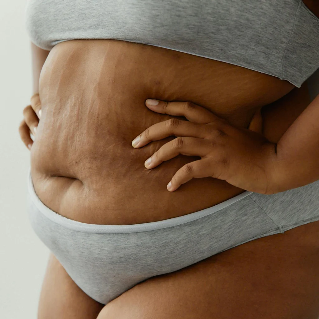 sindrome metabolica girovita