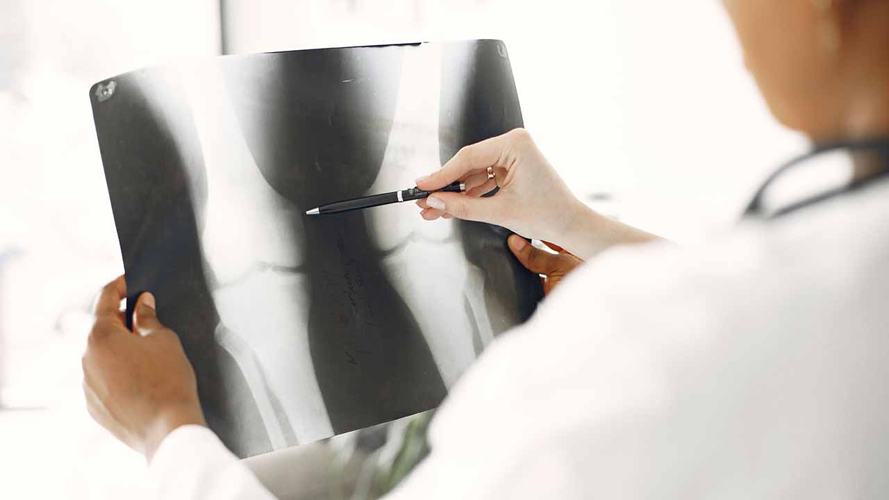 Densitometria ossea (MOC): quando eseguire l’esame per valutare la fragilità delle ossa